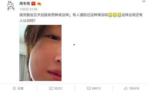 娱乐圈吃瓜爆料营销号,揭秘幕后推手与虚假信息泛滥 第2张 娱乐圈吃瓜爆料营销号,揭秘幕后推手与虚假信息泛滥 第2张