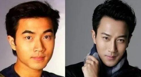娱乐圈吃瓜爆料男星整容,男星整容真相大揭秘