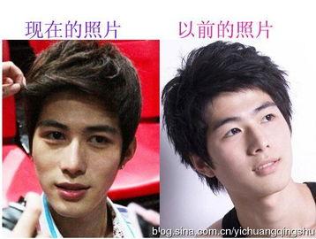 娱乐圈吃瓜爆料男星整容,男星整容真相大揭秘 第2张 娱乐圈吃瓜爆料男星整容,男星整容真相大揭秘 第2张
