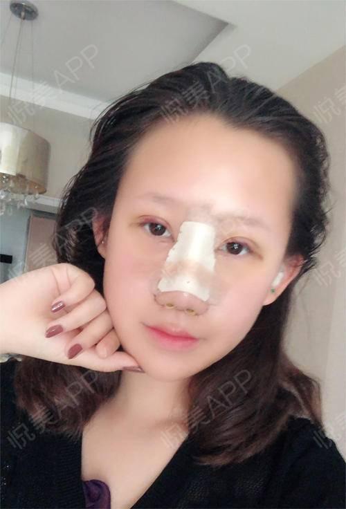 娱乐吃瓜酱不用做鼻子 第3张 娱乐吃瓜酱不用做鼻子 第3张
